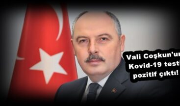 Vali Coşkun’un Kovid-19 testi pozitif çıktı!