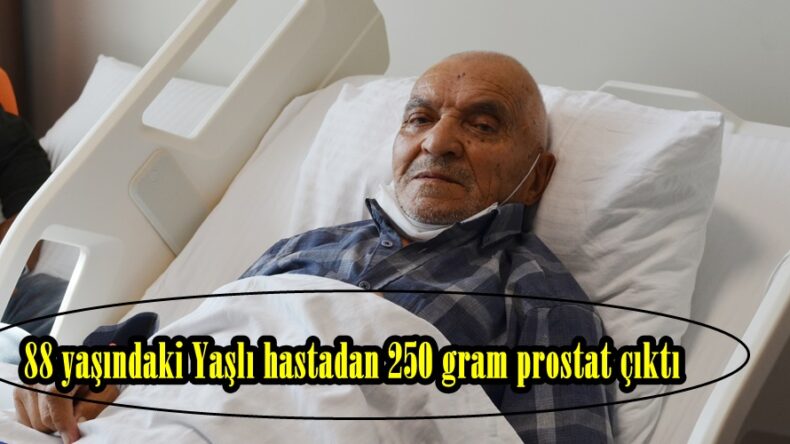 88 yaşındaki Yaşlı hastadan 250 gram prostat çıktı.